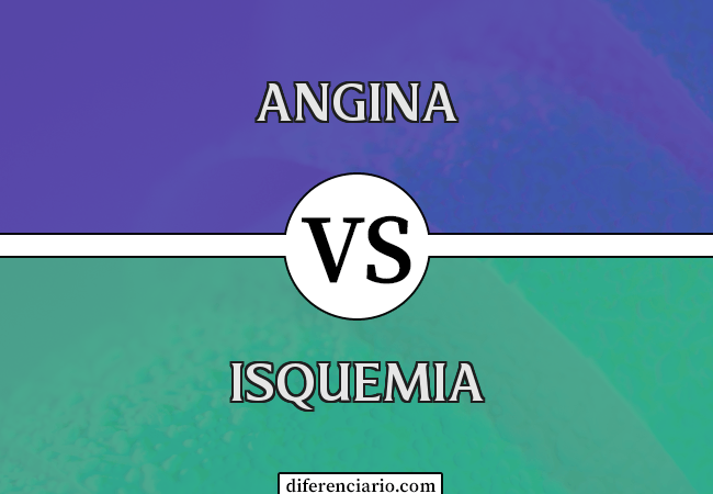 Diferença entre angina e isquemia