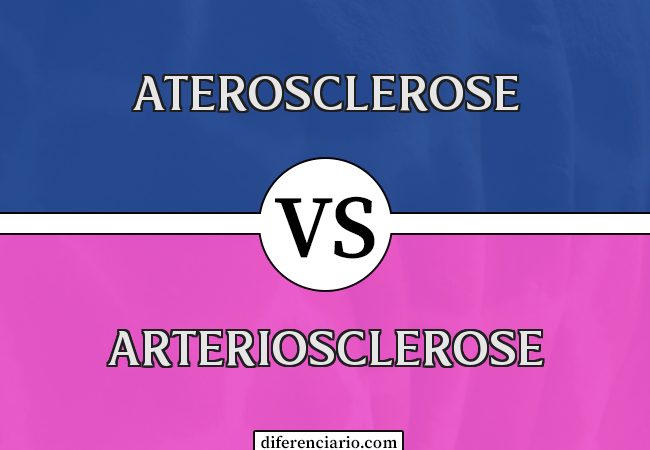 Diferença entre aterosclerose e arteriosclerose