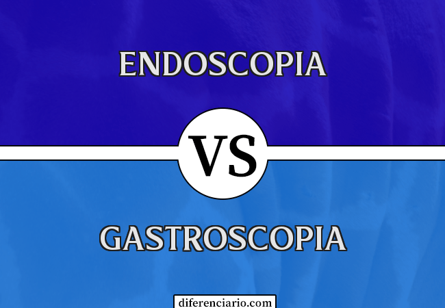 Diferença entre endoscopia e gastroscopia