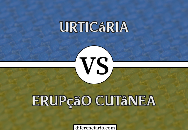 Diferença entre urticária e erupção cutânea