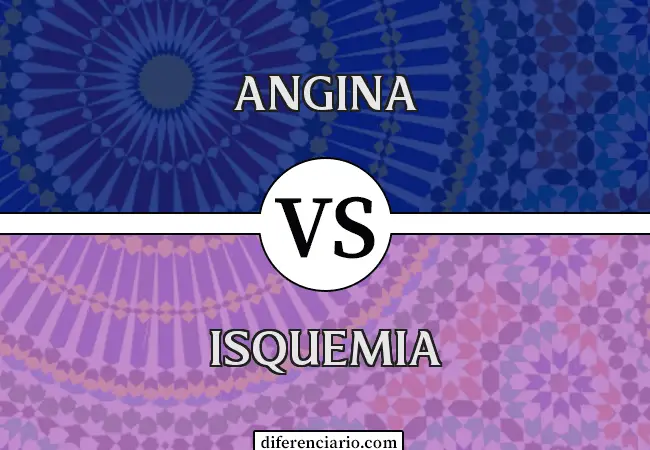 Diferencia entre angina e isquemia