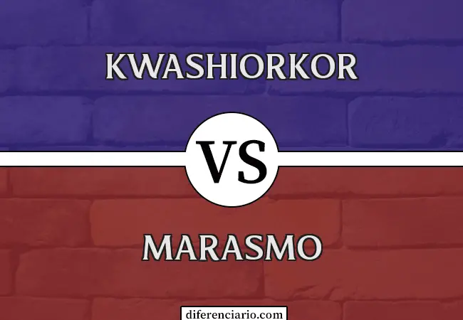 Diferencia entre Kwashiorkor y Marasmo